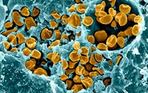 The Pentagon Bio-Weapons